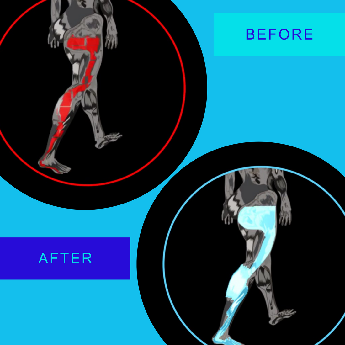 How the Stability Bar Kit Works